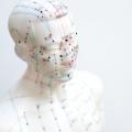 Acupuncture tete meridien